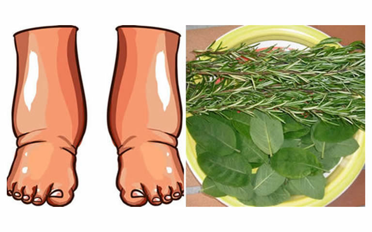 remedii naturiste pentru picioare umflate