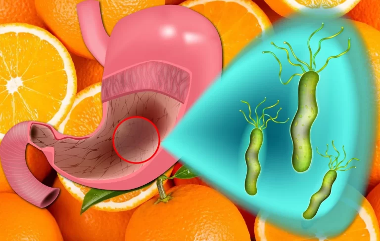 tratamente-naturiste-helicobacter-pylori